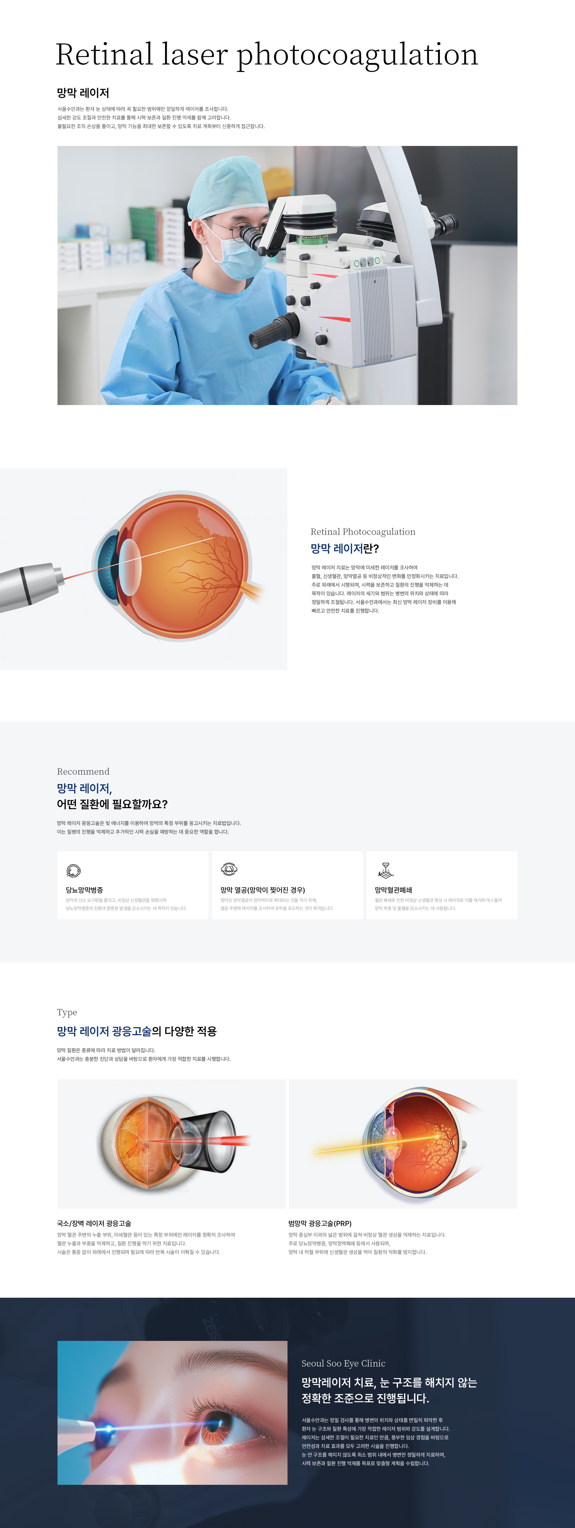 서울수안과는 환자 눈 상태에 따라 꼭 필요한 범위에만 정밀하게 레이저를 조사합니다. 섬세한 강도 조절과 안전한 치료를 통해 시력 보존과 질환 진행 억제를 함께 고려합니다. 불필요한 조직 손상을 줄이고, 망막 기능을 최대한 보존할 수 있도록 치료 계획부터 신중하게 접근합니다.
